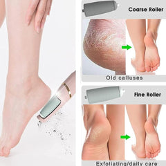 ELECTRIC Pedicure Tools Feet Care for Hard Cracked Foot - JVJ Prime